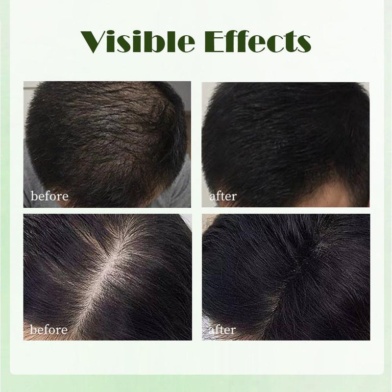 Bar Shampoo And Conditioner, Hair Strengthening Shampoo Bar, Solid Shampoo And Conditioner Set for All Hair Type - Image 5